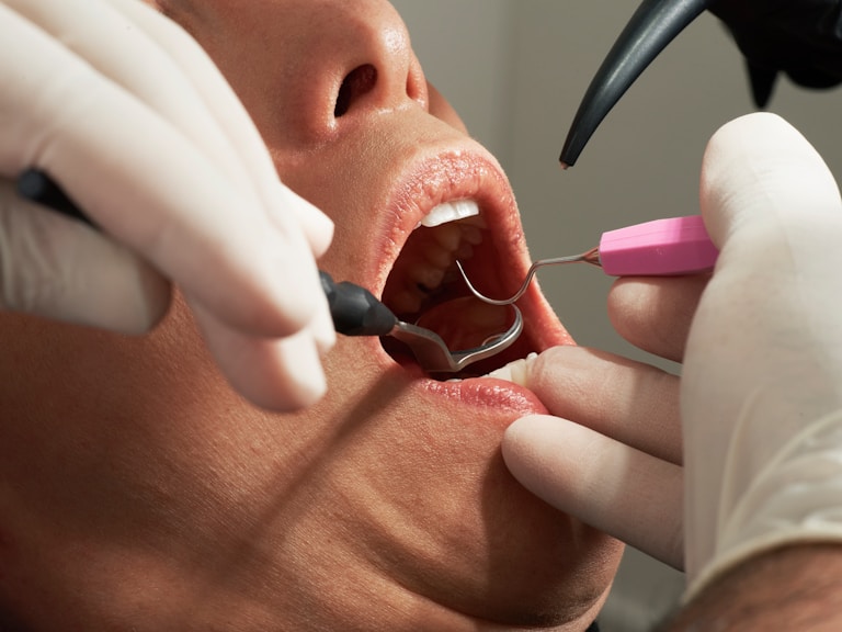 Perawatan gigi implan, veneer & clear aligner di Oda Dental Clinic Jakarta Utara