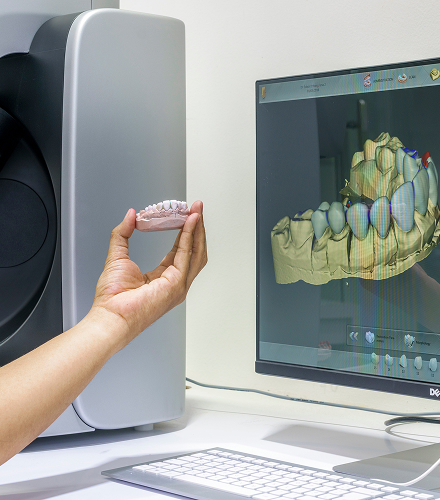Prosedur implan gigi digital tanpa operasi besar di Oda Dental Clinic