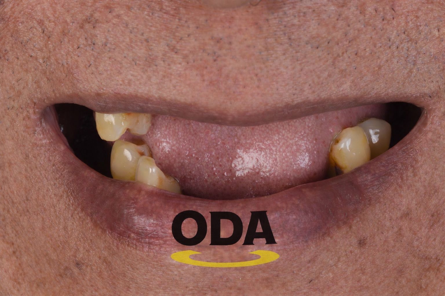Klinik Oda Dental Clinic Kelapa Gading Jakarta Utara