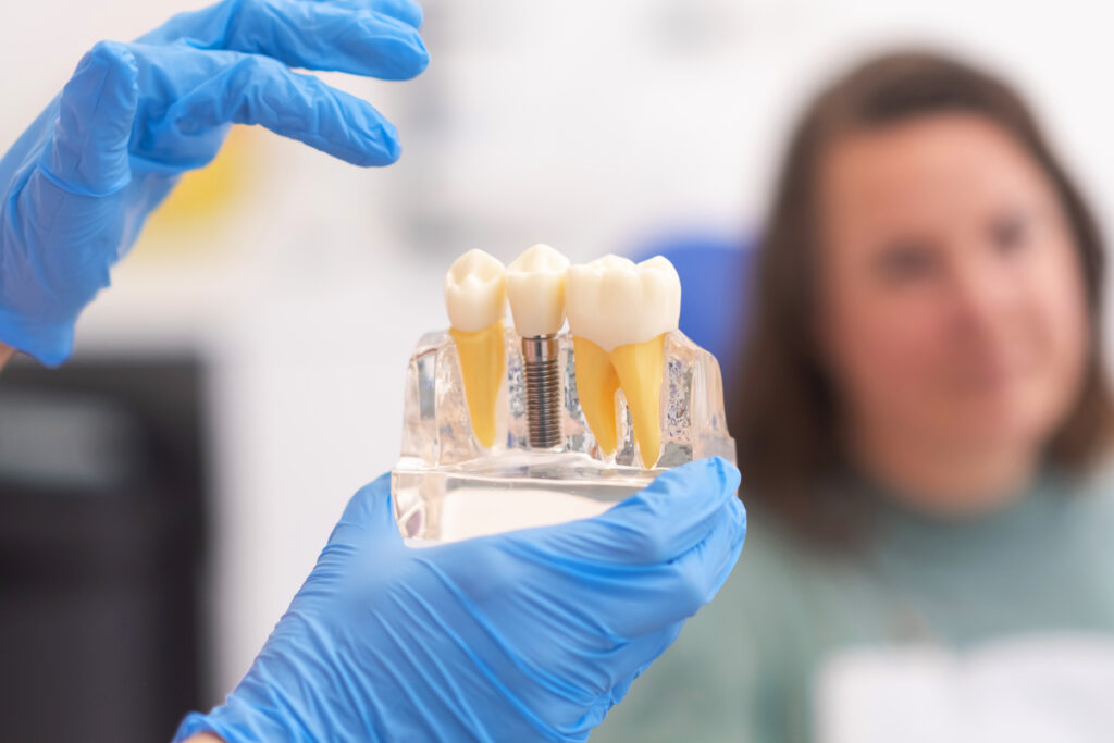 Prosedur implan gigi digital tanpa operasi besar di Oda Dental Clinic